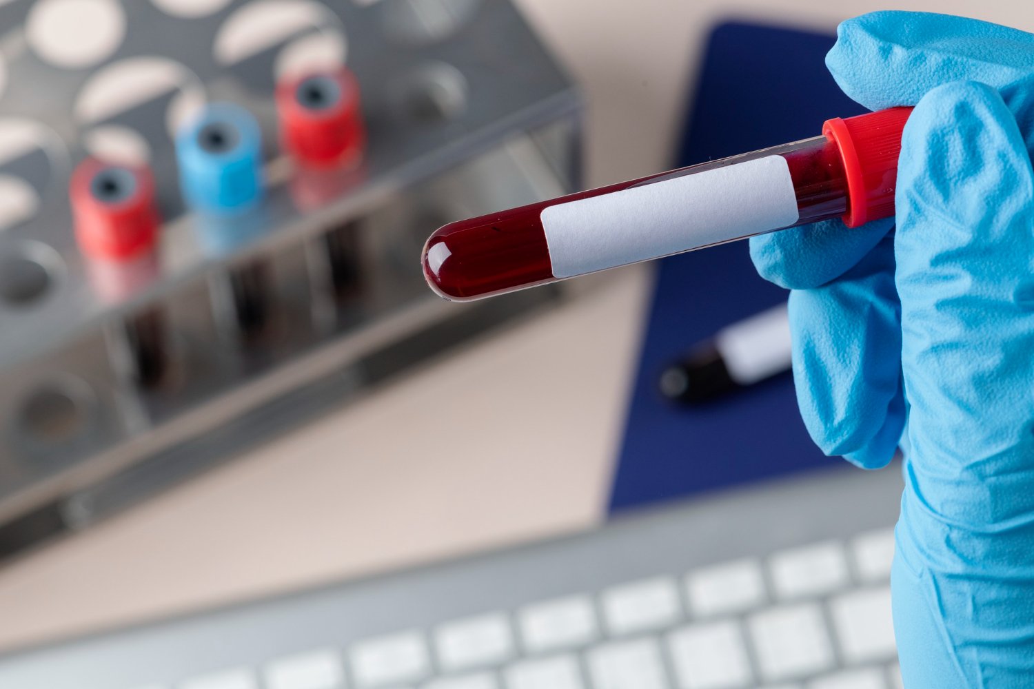 Understanding Hemoglobin Estimation: Why It Matters for Your Health