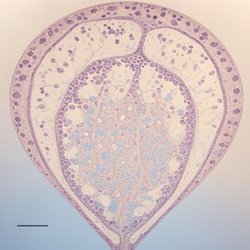 BREAST IMMUNOHISTOCHEMISTRY – [Tissue]