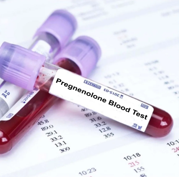 17-OH Pregnenolone