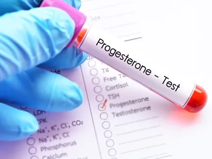 17-OH Progesterone