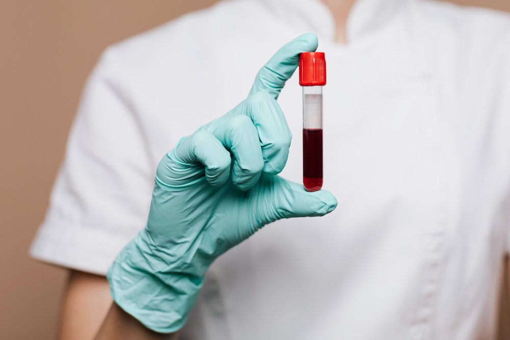 Pre-Wedding Tests (Philia) Female
